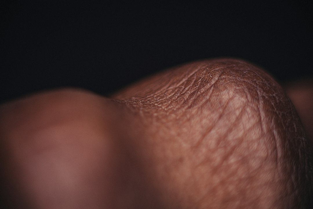 Nail Ridges and Vertical Lines: Signs of Health Issues You Shouldn't Ignore